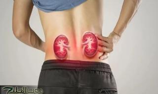 علامات تشير إلى إصابتك بمشكلات فى الكلى