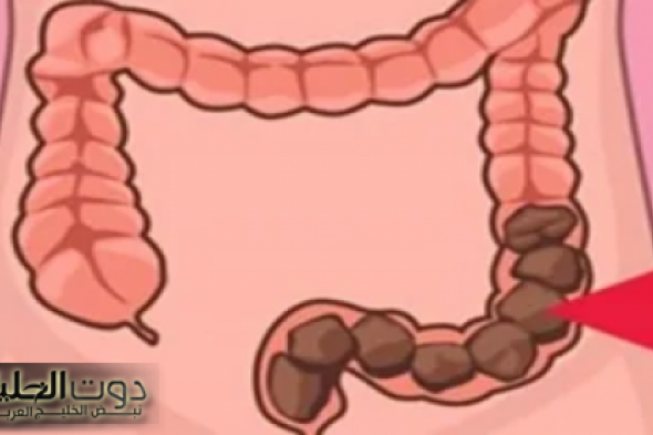 "حل جبار يغنيكي عن الدكاترة!"... شابة أردنية تكشف عن عشبة جبارة موجودة في كل مطبخ تنظف القولون في 5 دقائق وتعتبر الحل الأمثل للتخلص من البراز المتحجر!
