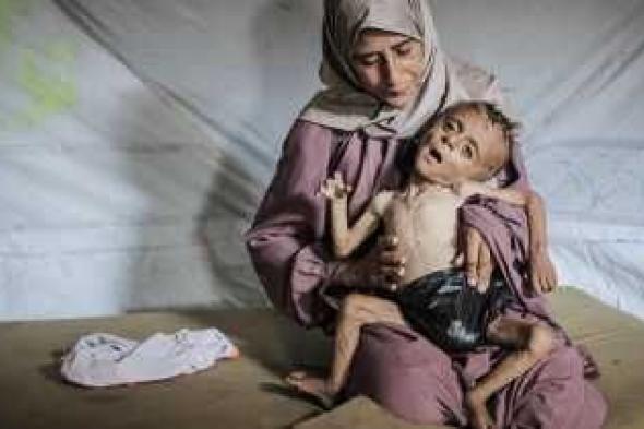 أخبار اليمن : المجاعة في غزة: 162 شهيداً بينهم 92 طفلاً